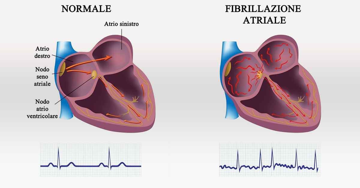 Esami Del Sangue A Verona Analisi Prevenzione Cardiovascolare Dott 